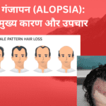 गंजापन (ALOPSIA): मुख्य कारण और उपचार