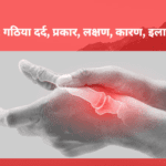 Arthritis: गठिया दर्द, प्रकार, लक्षण, कारण, इलाज