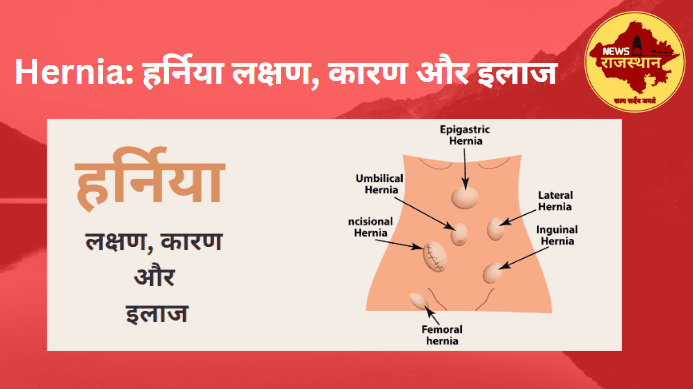 Hernia: हर्निया लक्षण, कारण और इलाज