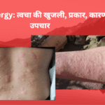 Skin Allergy: त्वचा की खुजली, प्रकार, कारण, उपचार