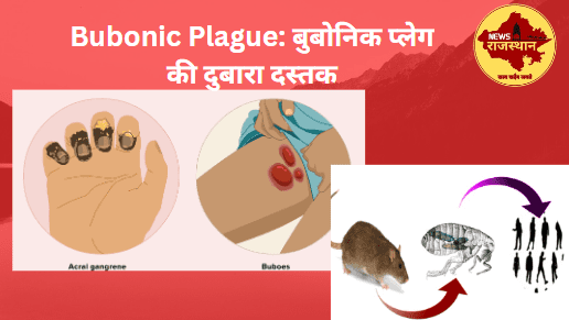 Bubonic Plague: बुबोनिक प्लेग की दुबारा दस्तक