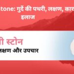 Kidney Stone: गुर्दे की पथरी, लक्षण, कारण, इलाज