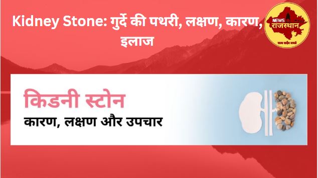 Kidney Stone: गुर्दे की पथरी, लक्षण, कारण, इलाज