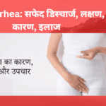 Leukorrhea: सफेद डिस्चार्ज, लक्षण, कारण, इलाज